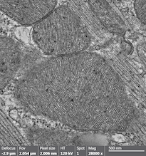 Mitocondrias de corazoón observadas con microscopía electrónica